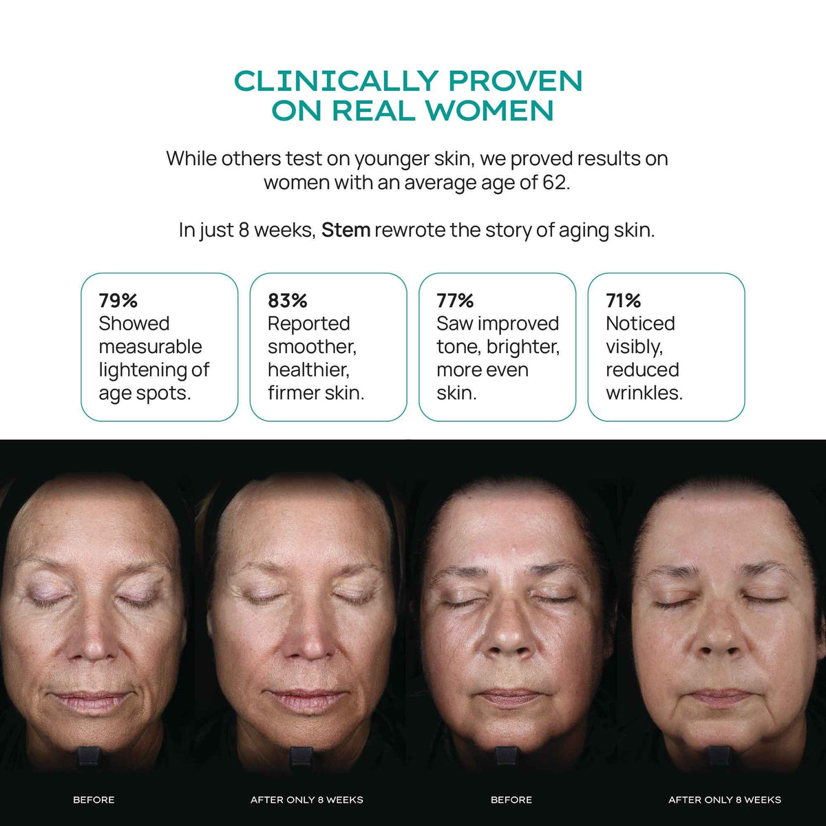ReGenerative Serum Trio + ReVitalize (Show Special)