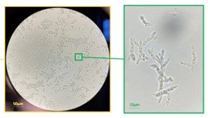 Ustiligo cells under the microscope!