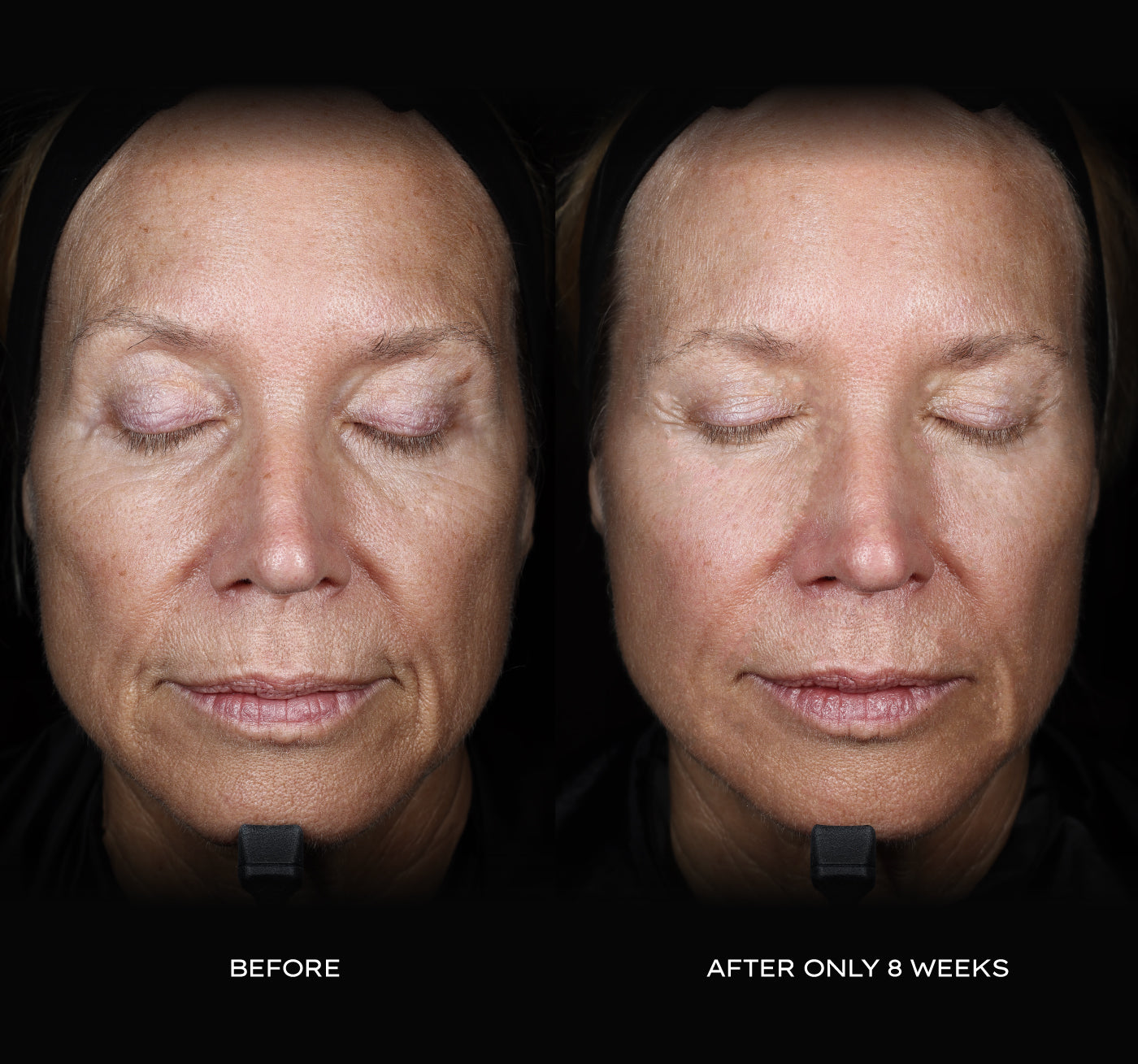 Regenerative Stem Cell Skincare | The Stem Company